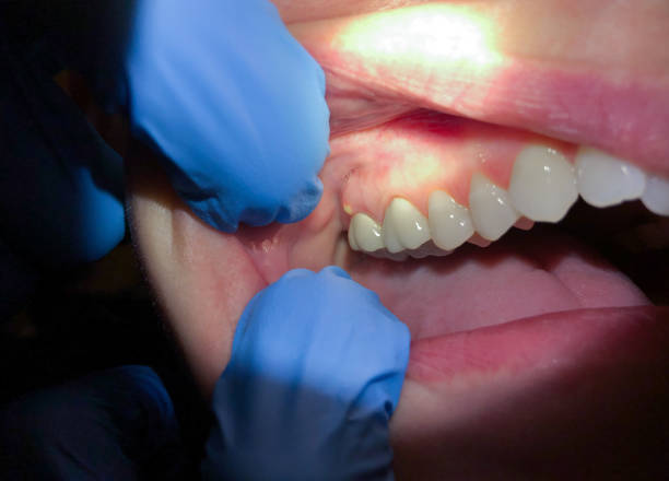 Best Dentist Open Late Near Me  in Hill N Dale, FL