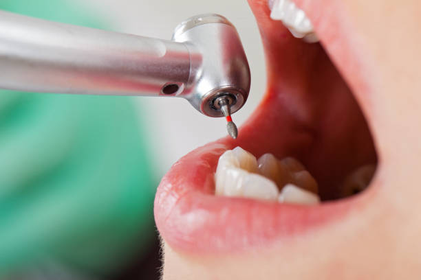Best Emergency Dentist Near Me  in Hill N Dale, FL